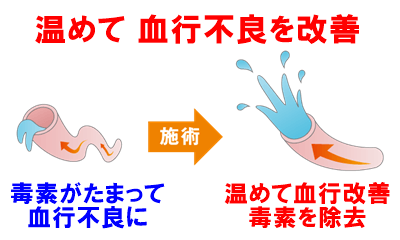 血行不良を改善